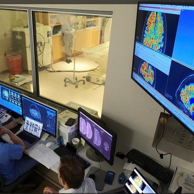 Alzheimer's drugs might get into the brain faster with new ultrasound tool, study shows